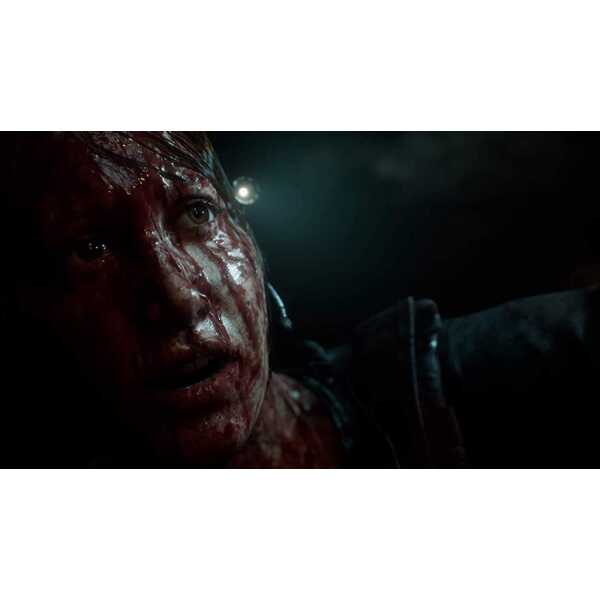 Intense close-up of a bloodied horror game character with a dark background.
